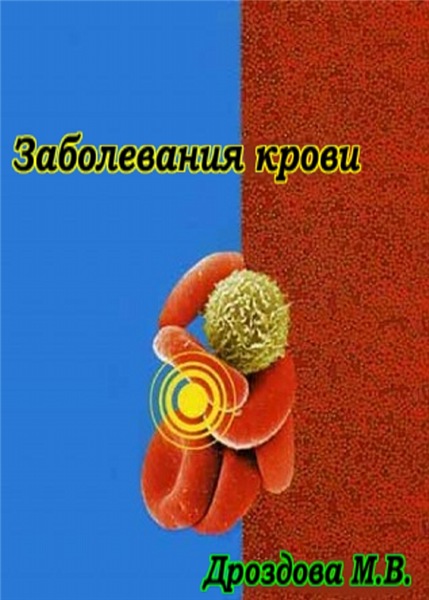 М.В. Дроздова. Заболевания крови